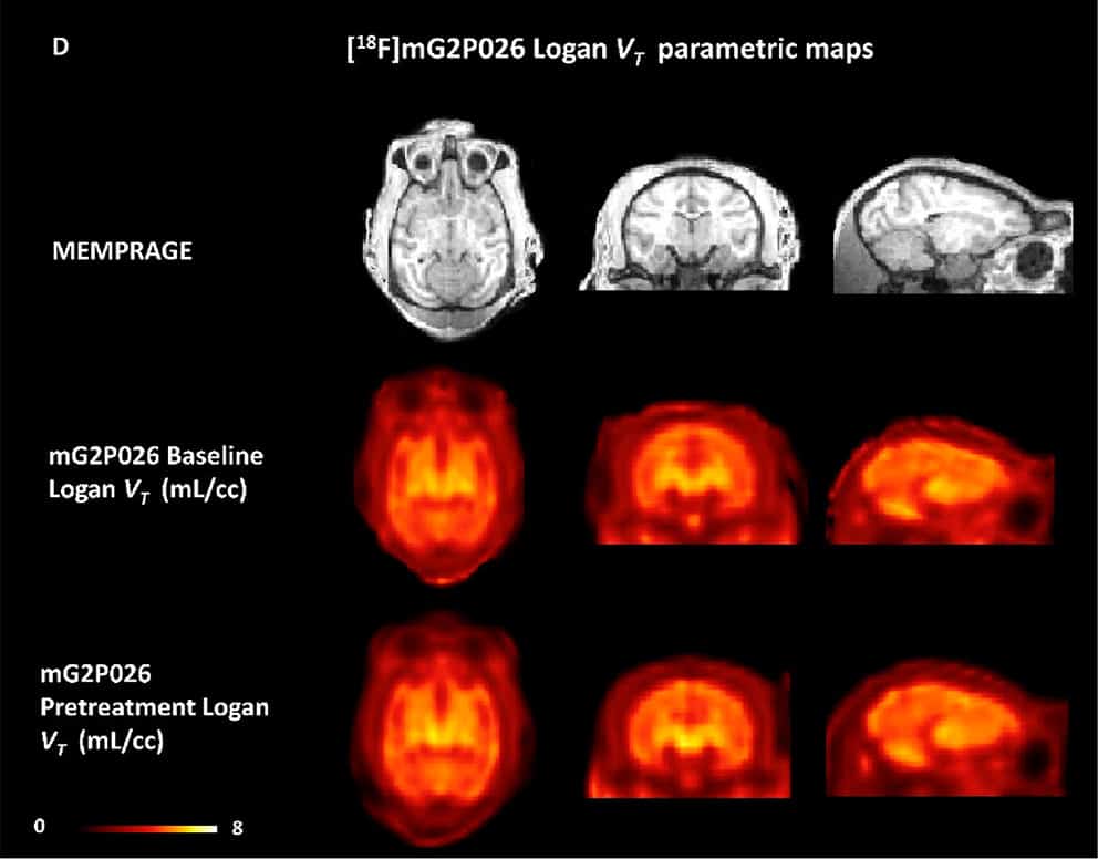Structural MRI (MEMPRAGE) and [18F]9 Logan VT images at t*30 min for the baseline and pretreatment condition