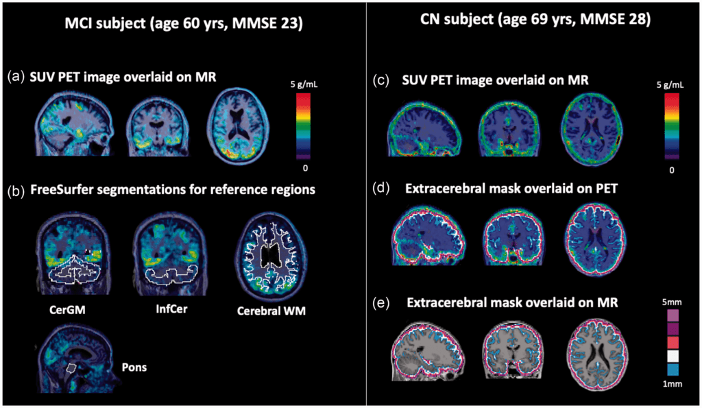 Example [18F]MK-6240 PET images and segmentations for the evaluated reference and extracerebral regions.