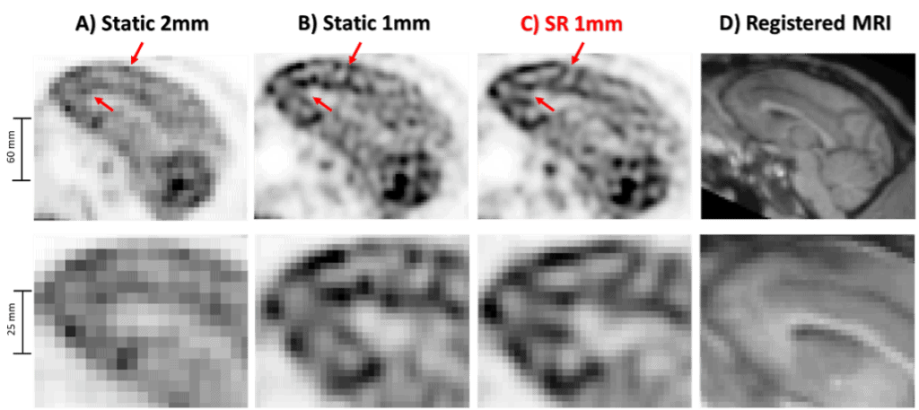 Results of the 18F-FDG NHP in vivo study. Same PET slice reconstructed with A) static OSEM with 2 mm voxels, B) static OSEM with 1 mm voxels, C) proposed SR method with 1 mm voxels, and D) corresponding MR slice.
