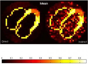 Comparison of the mean images between the direct and indirect approaches in estimating K1