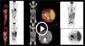 Video Lecture_Clinical Applications of PET