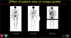 Video Lecture_Positron Emission Tomography (PET) I