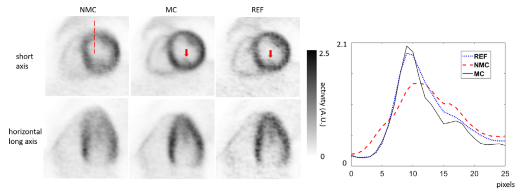 Non motion-corrected (NMC), motion-corrected (MC) and reference (REF) images with profiles
