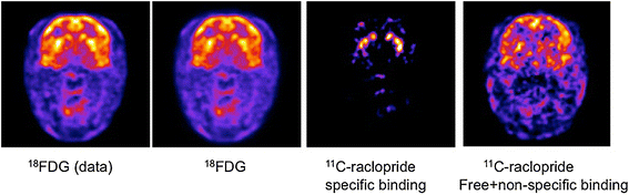 Factor images from application of GFADS to a mid-striatal, whole-brain slice of a dual-tracer rhesus monkey study. (Left to right) Ground truth FDG image (data), computed as the average of the initial three time frames; GFADS FDG image, demonstrating the same features as the ground truth image; GFADS specifically bound 11C-raclopride factor; derived free + nonspecifically bound GFADS factor image.