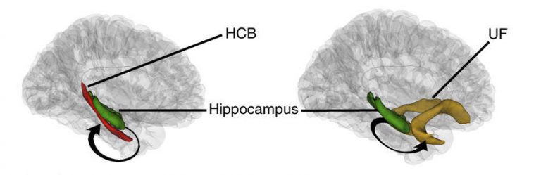 Brain regions, HCB, hippocampus and UF, labeled