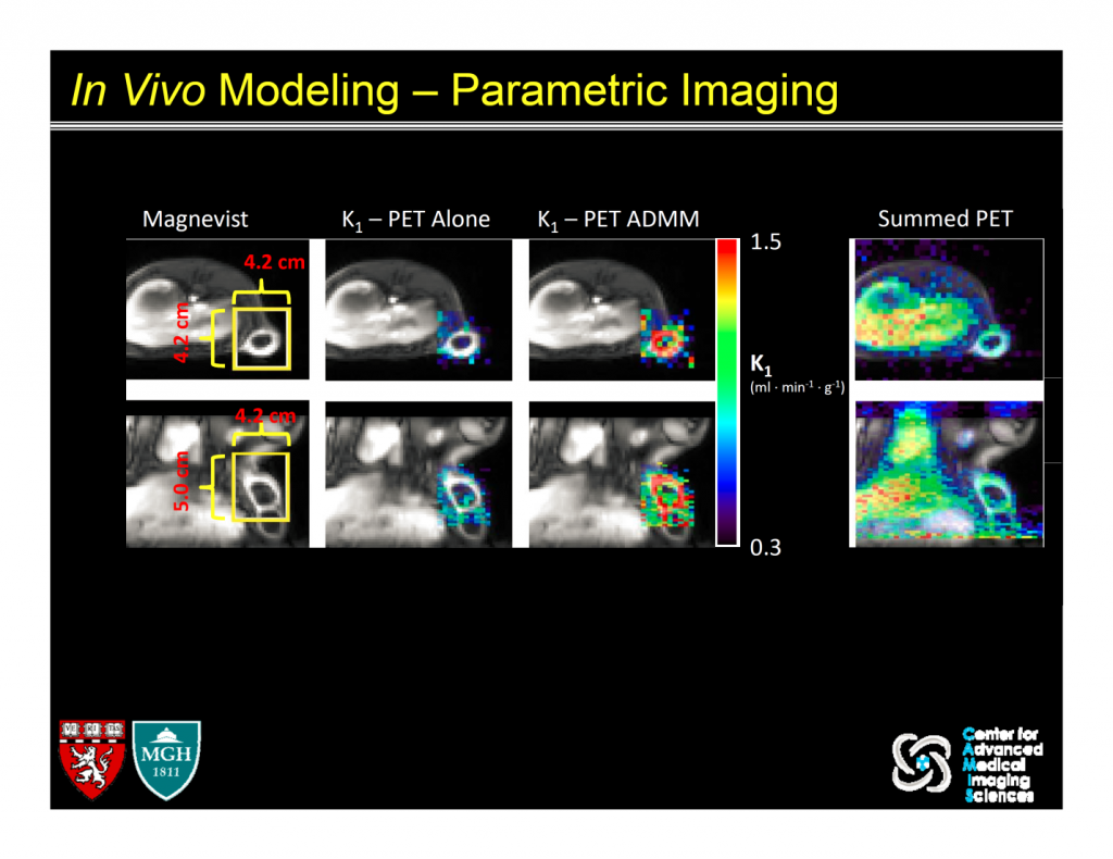Parametric maps of K1 using PET alone or PET with MRI (ADMM method)